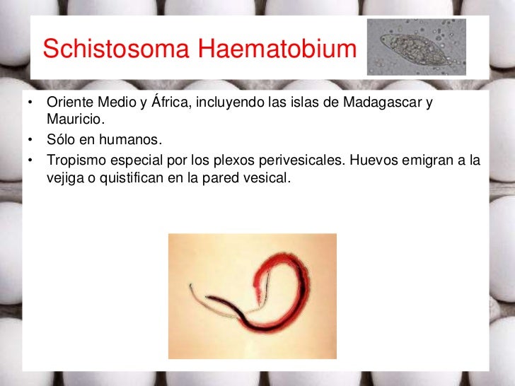 esquistosomiasis urinaria